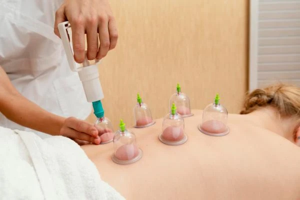 Massage avec ventouses